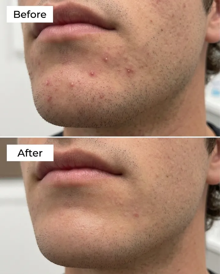 Customer before & after photo