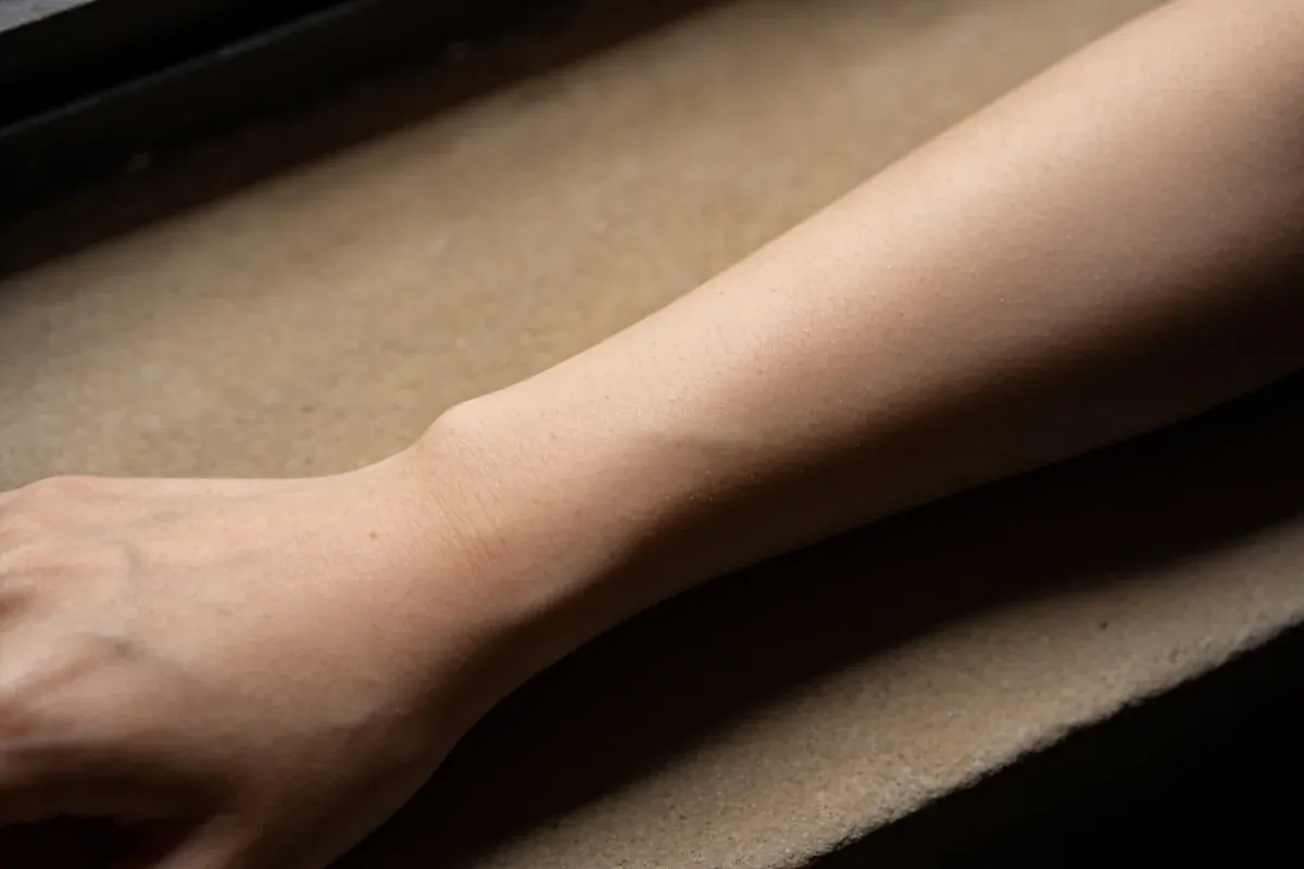 Close view of forearm skin texture resting on a warm stone surface in soft light, fungal acne