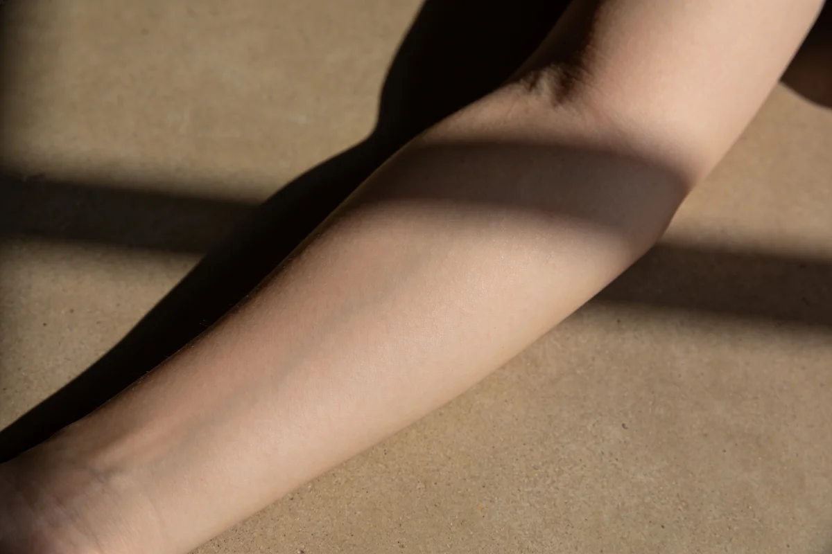 Close view of forearm skin texture in soft light, fungal acne vs closed comedones